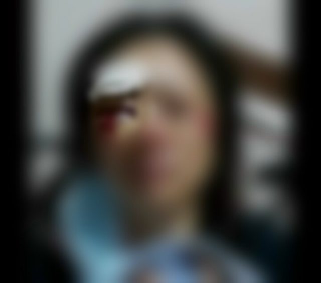Wanita Tersungkur Ketika Ditarik Jambret
