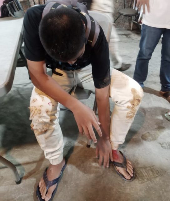 Warga Keluhkan Jalan Indunsuri Tanjunguban Berdebu, Sudah Makan Korban Laka
